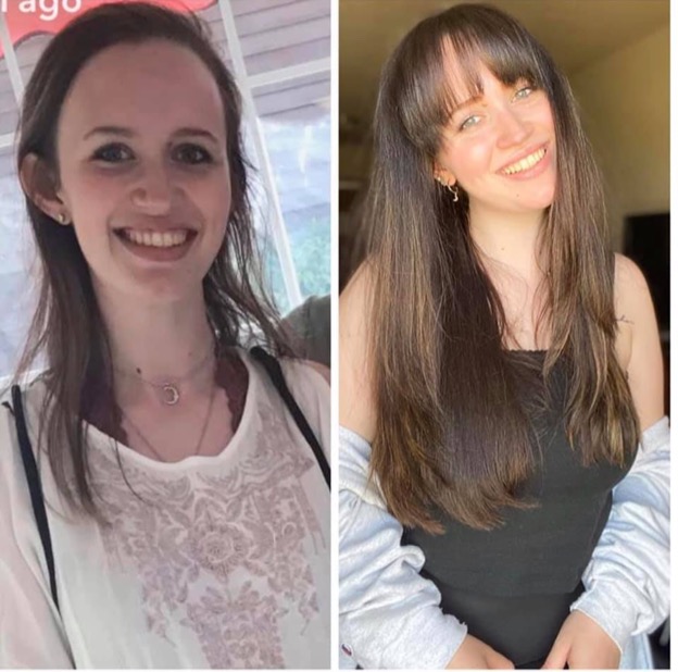 Before and after of a woman's hair regrowth. The first photo she has very thin dull hair, the second photo her hair is long and full.