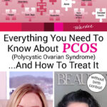 Photo collage of two women, and a stock photo of jigsaw puzzle pieces labeled with different symptoms of PCOS. Text overlay says: "Putting Together The Pieces of PCOS: Everything You Need To Know About PCOS (Polycystic Ovarian Syndrome) ... And How To Treat It Without Birth Control!"