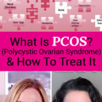 Photo collage of two women giving an interview, and a stock photo of puzzle pieces labeled with the symptoms of PCOS. Text overlay says: "What Is PCOS? (Polycystic Ovarian Syndrome) & How To Treat It (without birth control!)"
