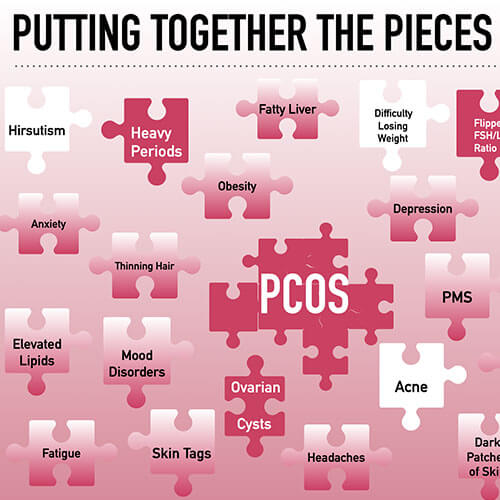 Graphic of jigsaw puzzle pieces labeled with the signs and symptoms of PCOS, including hirsutism, heavy periods, anxiety and more.