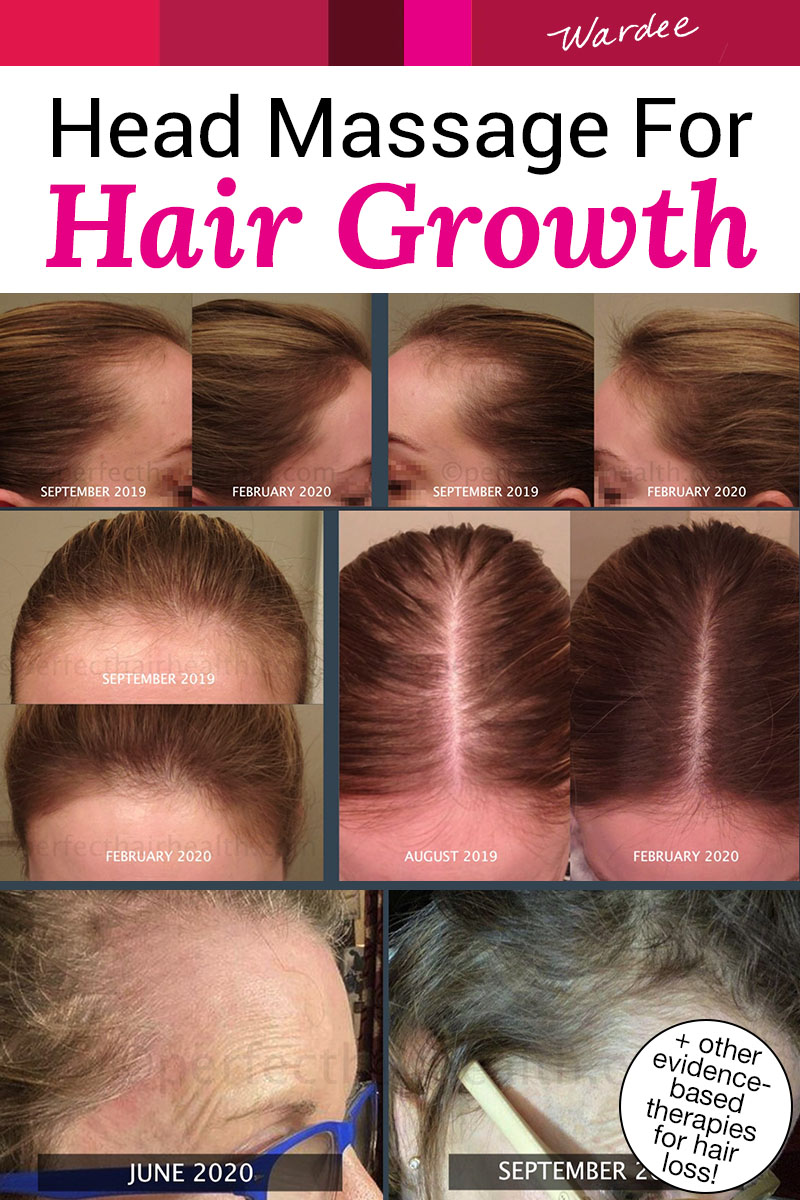 Photo collage before and after shots of women with thinning hair, showing how their hair has grown back within a period of months. Text overlay says: "Head Massage for Hair Growth (+other evidence-based therapies for hair loss!)"