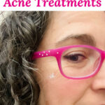Close-up photo of a smiling woman wearing pink glasses with a spot on her cheek. Text overlay says: "3 Best Natural Acne Treatments (spot treatment and all over!)"