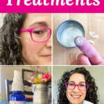 Photo collage of a smiling woman wearing pink glasses demonstrating various acne treatments, of white powder on a woman's fingertip, and a spray bottle labeled "zinc". Text overlay says: "3 DIY Acne Treatments (better than benzoyl peroxide or salicylic acid)"